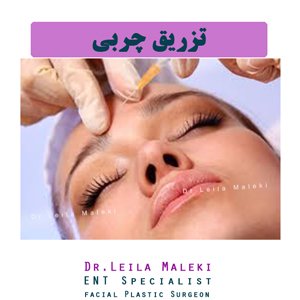 تزریق چربی به صورت