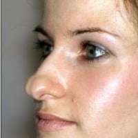 نوک-بینی-گرد