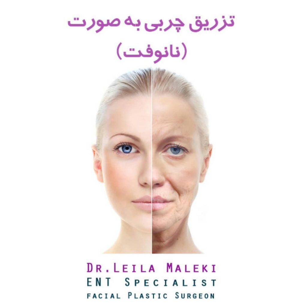 تزریق چربی به صورت به روش نانوفت