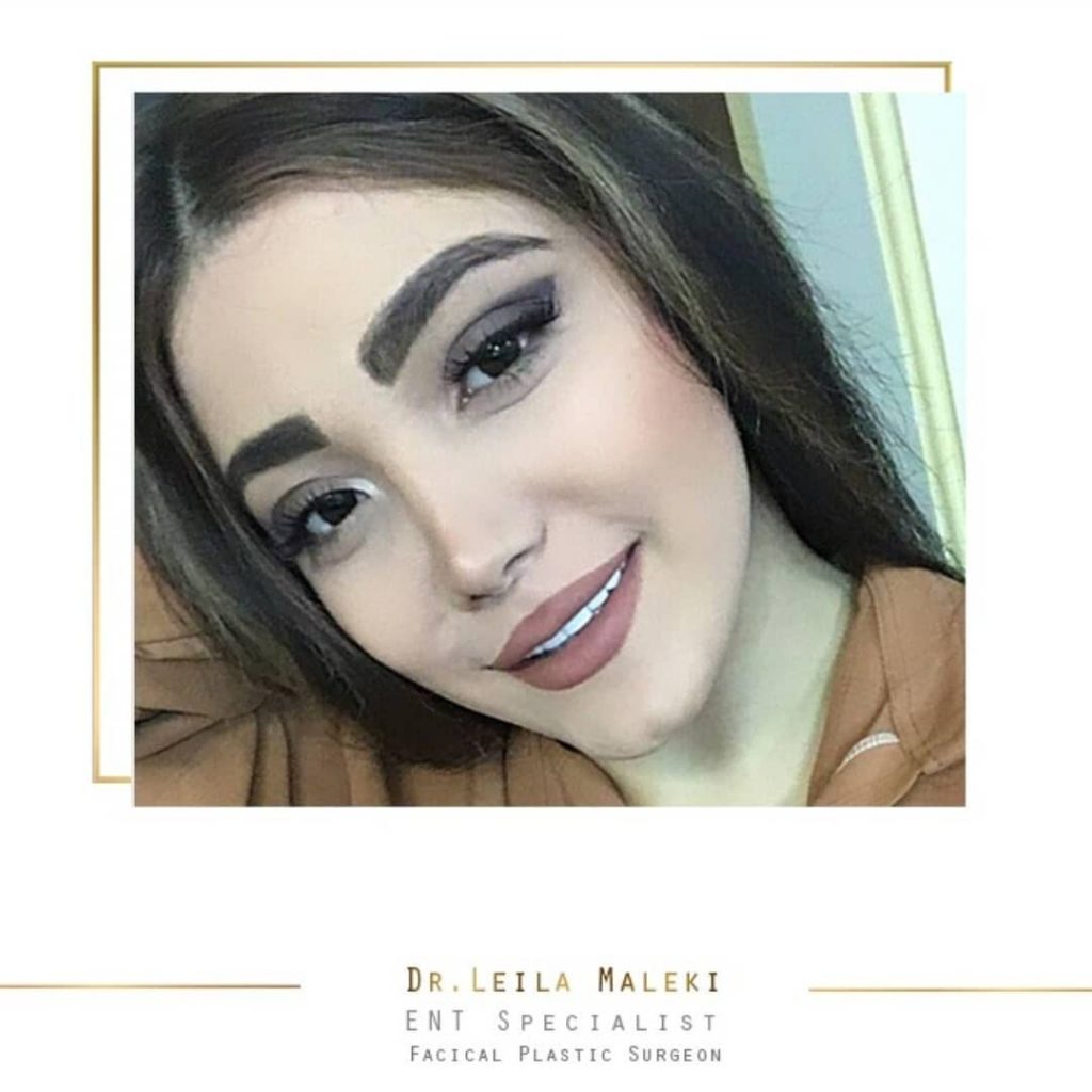 بهترین سن جراحی بینی