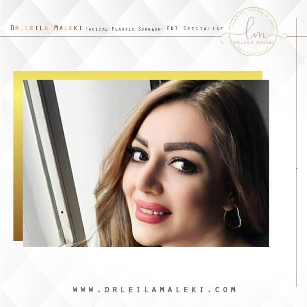 نمونه جراحی بینی دکتر لیلا ملکی
