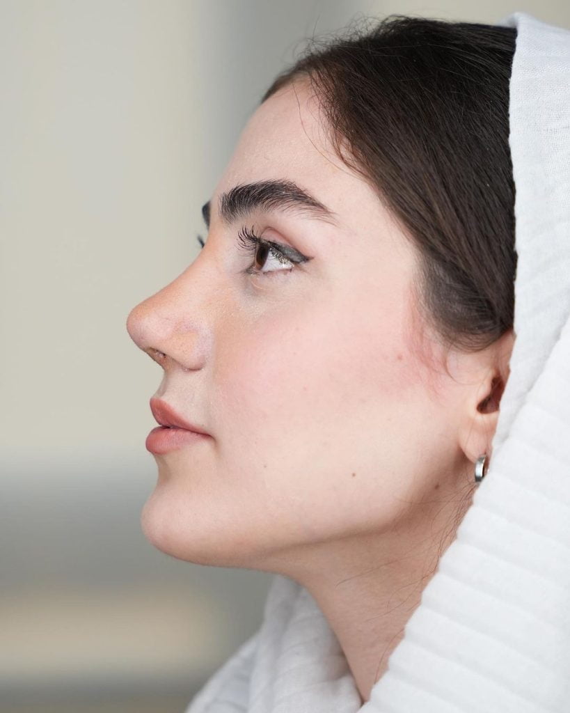 همه چیز درباره جراحی بینی