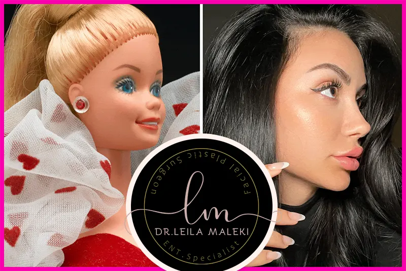 جراحی بینی به سبک باربی و ترند Barbie Nose