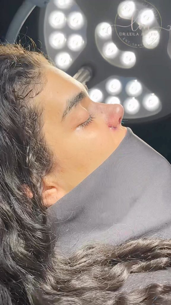 فوق‌غذاهایی که بهبودی بینی شما را معجزه آسا سریع می‌کنند! (۴ ماده غذایی کلیدی)