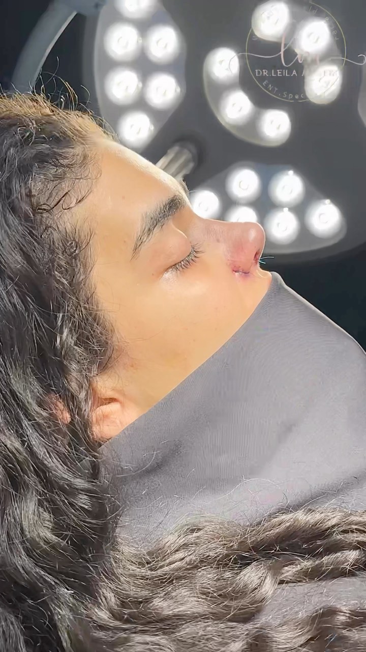 <a