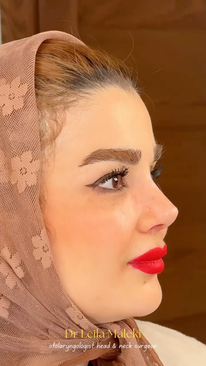 ویدیوی دکتر لیلا ملکی