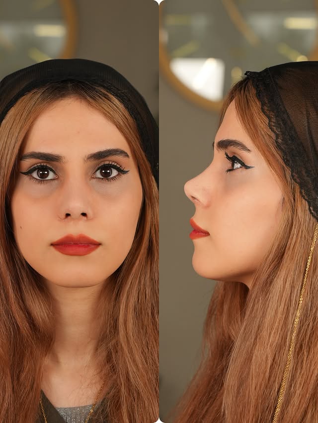 نمونه‌کار دکتر لیلا ملکی