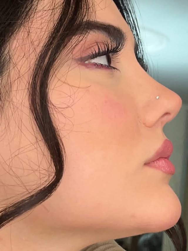 نمونه‌کار دکتر لیلا ملکی