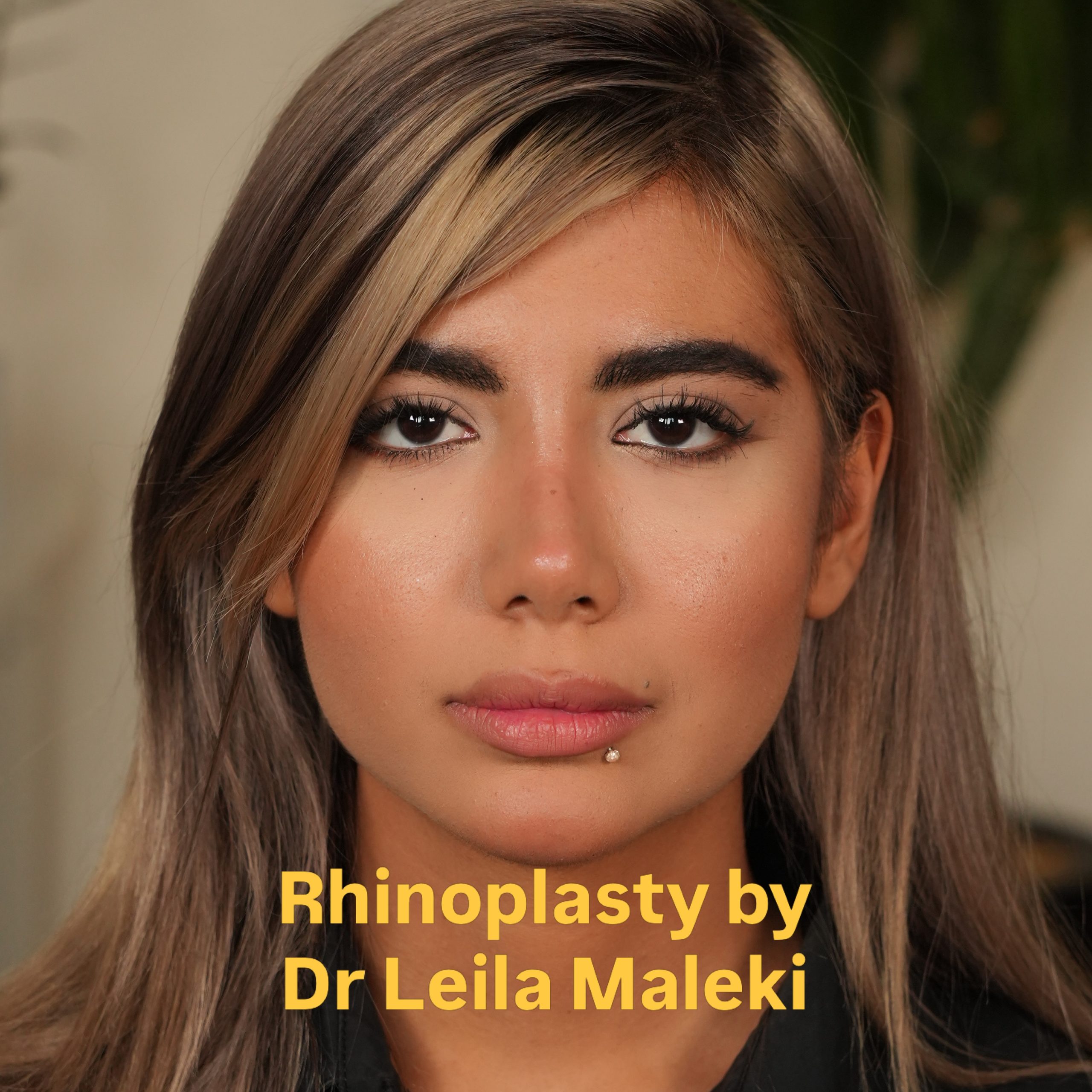 نمونه‌کار دکتر لیلا ملکی