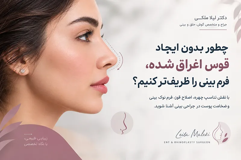 چطور بدون ایجاد قوس اغراق‌شده، فرم بینی را ظریف‌تر کنیم؟